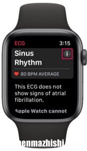 苹果手表心电图应用怎么用，Apple Watch上记录心电图方法