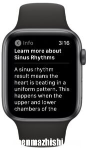 苹果手表心电图应用怎么用，Apple Watch上记录心电图方法